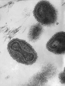 Virus de viruela Gil-NagelM.JPG